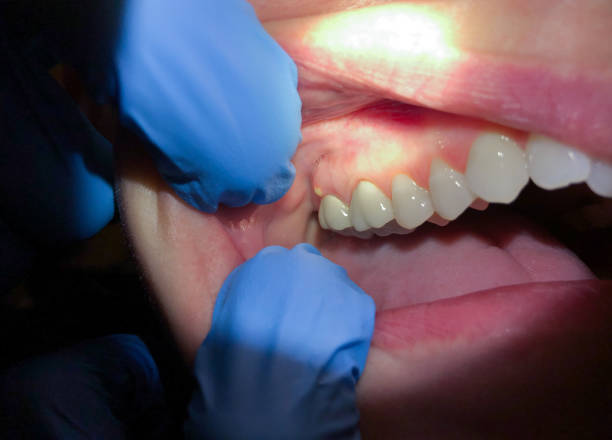 Best Emergency Cosmetic Dentistry (e.g., broken veneers) in Fairfax, OH