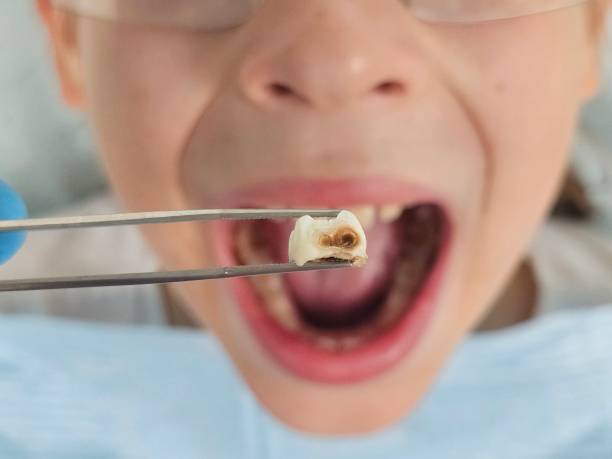 Best Emergency Pediatric Dental Care in Fairfax, OH